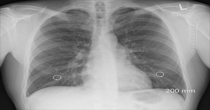 diagnosis-g38a010b47_1920_0.jpg