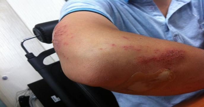 injury-199025_1920_0.jpg
